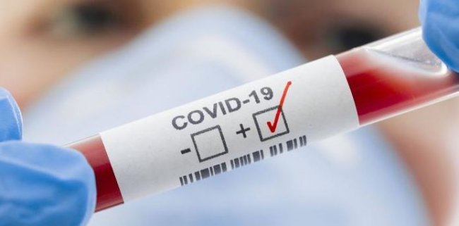 � ������ ����� ������������ COVID-19 �� ����� ����� ����� ���� 19 ���.